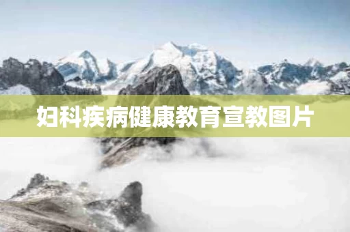 妇科疾病健康教育宣教图片